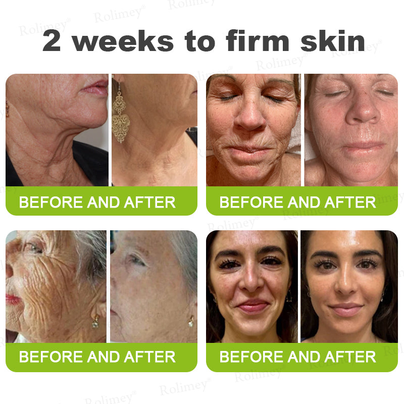 💐👨‍⚕️Made and Shipped from the Canada ✅Rolimey® Botox & Vita-A Retinol Shot Wrinkle-Lift Tightening stick- Last Day Promotion 70% OFF🔥LAST DAY 70% OFF