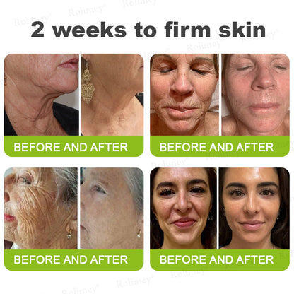 💐👨‍⚕️Made and Shipped from the Canada ✅Rolimey® Botox & Vita-A Retinol Shot Wrinkle-Lift Tightening stick- Last Day Promotion 70% OFF🔥LAST DAY 70% OFF