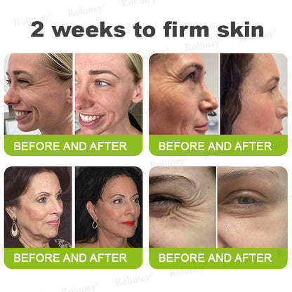 🌟Made and shipped from Canada 💫Rolimey® Botox & Vita-A Retinol Shot Wrinkle-Lift Tightening cream - Last Day Promotion 70% OFF
