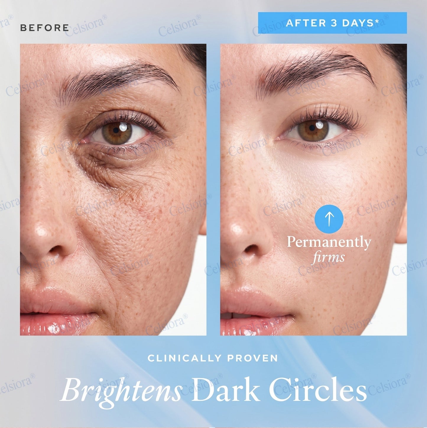 💫Celsiora® Botox & PDRN Anti-Wrinkle Shot – Lift & Firming Cream