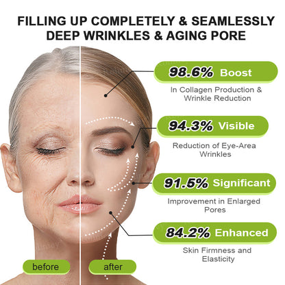 🌟Made and shipped from Canada 💫Rolimey® Botox & Vita-A Retinol Shot Wrinkle-Lift Tightening cream - Last Day Promotion 70% OFF