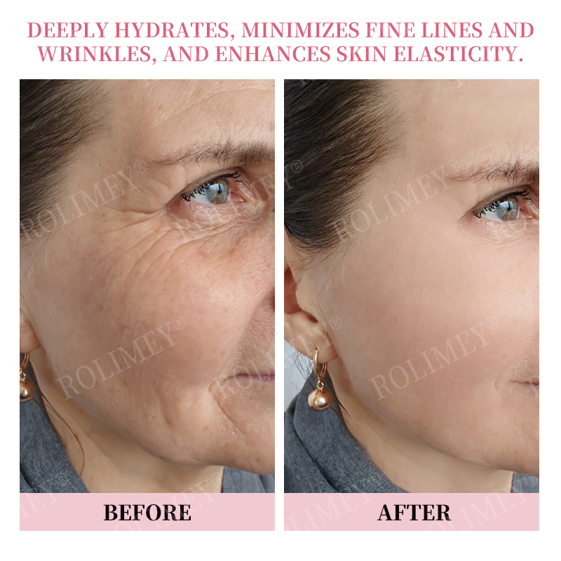 👨‍⚕️😍Made and Shipped from Australia✅Rolimey®Botox & Stem Cell Firming Anti-Wrinkle Cream Last Day 70% OFF!
