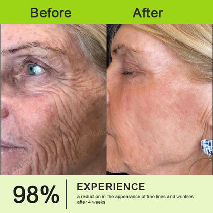 💐👨‍⚕️Made and Shipped from the Canada ✅Rolimey® Botox & Vita-A Retinol Shot Wrinkle-Lift Tightening stick- Last Day Promotion 70% OFF🔥LAST DAY 70% OFF