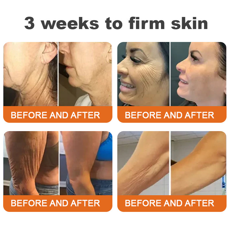 💐💐✅Made and Shipped from Canada✨Flysmus™ Botox Bee Venom Firming Serum Stick🔥LAST DAY 70% OFF