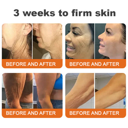 💐💐✅Made and Shipped from Canada✨Flysmus™ Botox Bee Venom Firming Serum Stick🔥LAST DAY 70% OFF