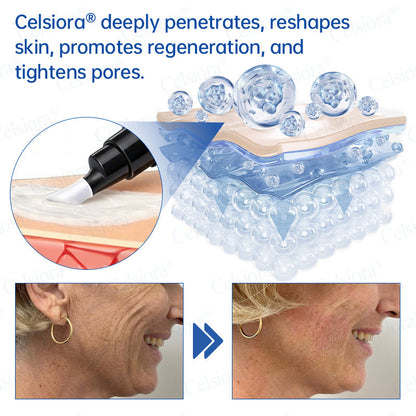 💫Celsiora® Botox & PDRN Anti-Wrinkle Shot – Lift & Firming Cream