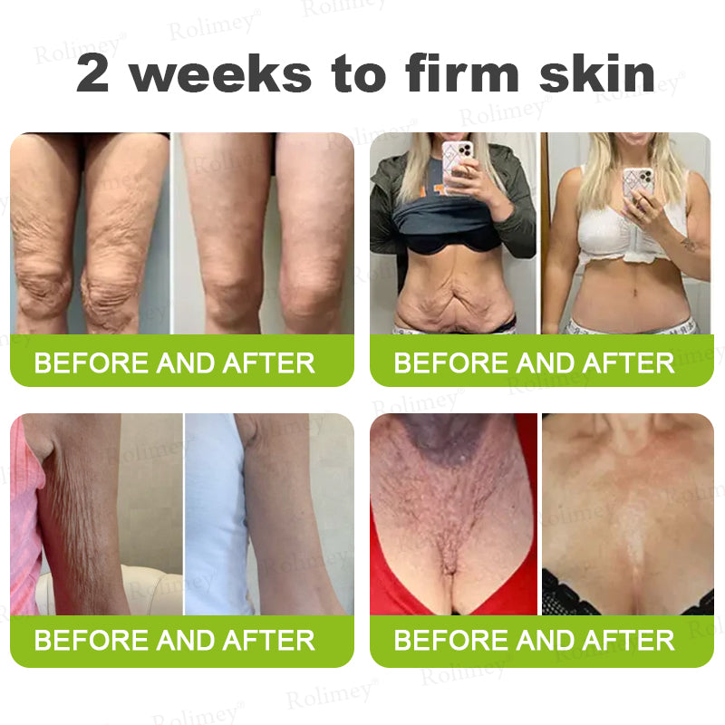 🌟Made and shipped from Canada 💫Rolimey® Botox & Vita-A Retinol Shot Wrinkle-Lift Tightening cream - Last Day Promotion 70% OFF