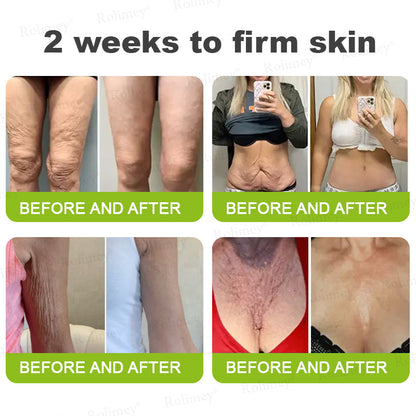 🌟Made and shipped from Canada 💫Rolimey® Botox & Vita-A Retinol Shot Wrinkle-Lift Tightening cream - Last Day Promotion 70% OFF