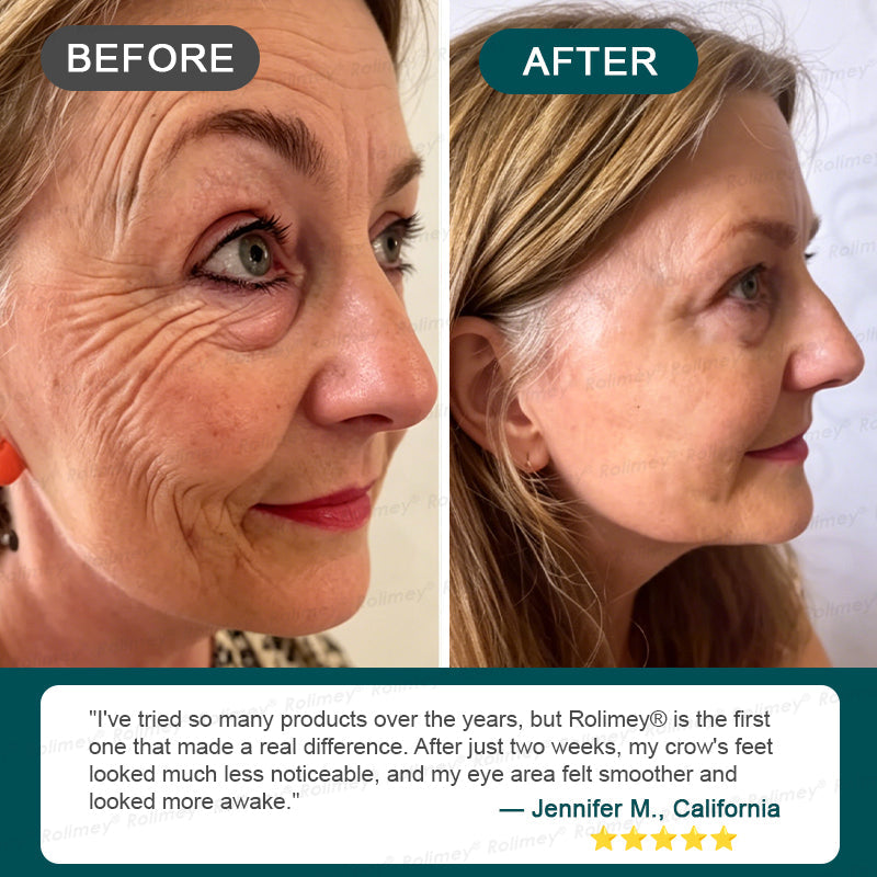 🌿👨‍⚕️CA HOT SALES ✨Rolimey® Botox & Stem Cell Wrinkle-Lift Tightening Cream