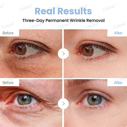 💫Celsiora® Botox & PDRN Anti-Wrinkle Shot – Lift & Firming Cream
