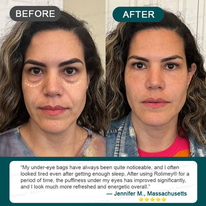 🌿👨‍⚕️CA HOT SALES ✨Rolimey® Botox & Stem Cell Wrinkle-Lift Tightening Cream