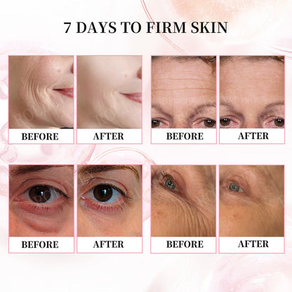 👨‍⚕️😍Made and Shipped from Australia✅Rolimey®Botox & Stem Cell Firming Anti-Wrinkle Cream Last Day 70% OFF!