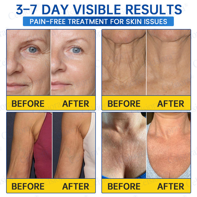 💫Celsiora® Botox & PDRN Anti-Wrinkle Shot – Lift & Firming Cream