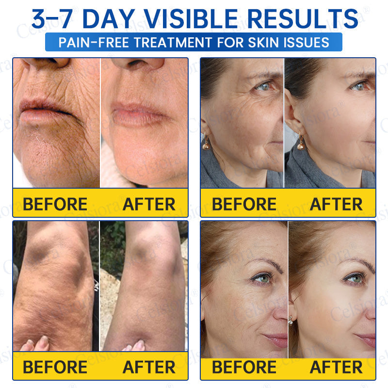 💫Celsiora® Botox & PDRN Anti-Wrinkle Shot – Lift & Firming Cream