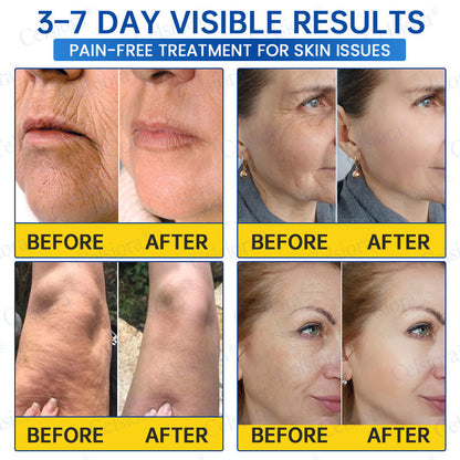 💫Celsiora® Botox & PDRN Anti-Wrinkle Shot – Lift & Firming Cream