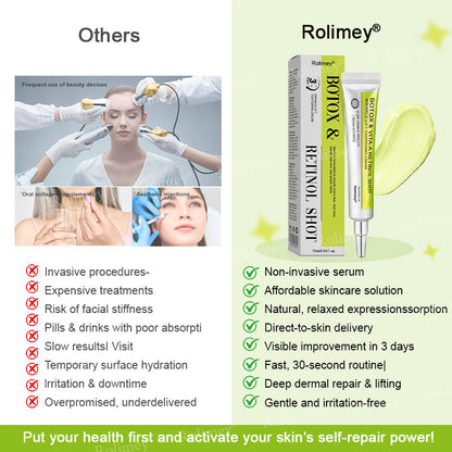 🌟Made and shipped from Canada 💫Rolimey® Botox & Vita-A Retinol Shot Wrinkle-Lift Tightening cream - Last Day Promotion 70% OFF