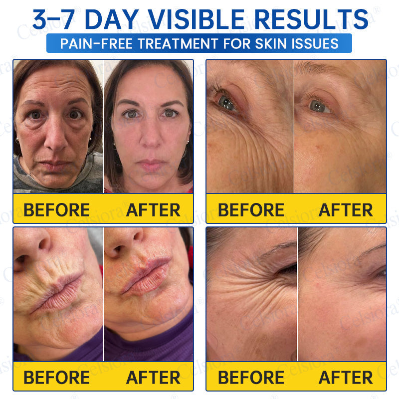 💫Celsiora® Botox & PDRN Anti-Wrinkle Shot – Lift & Firming Cream
