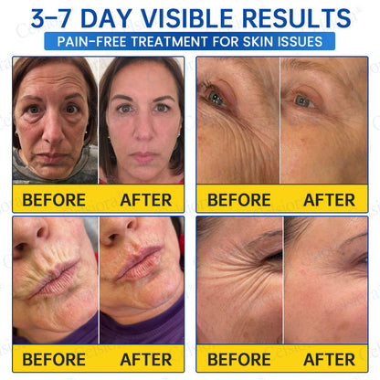 💫Celsiora® Botox & PDRN Anti-Wrinkle Shot – Lift & Firming Cream