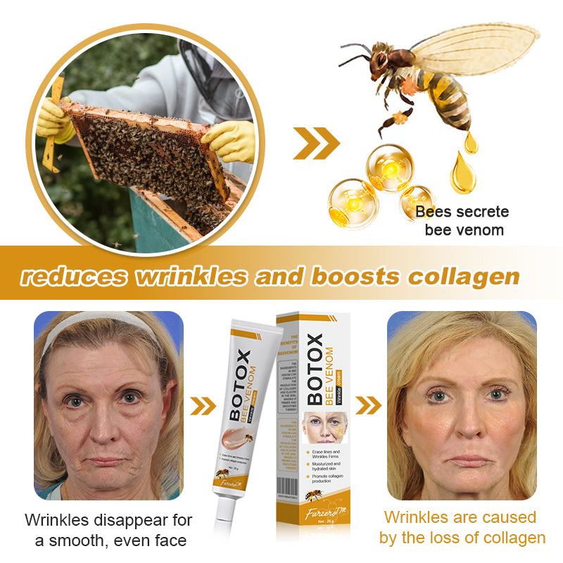✨🍀Made and shipped from Canada✅ Furzero™ Botox Bee Venom Wrinkle Removal Cream- LAST DAY 70% OFF