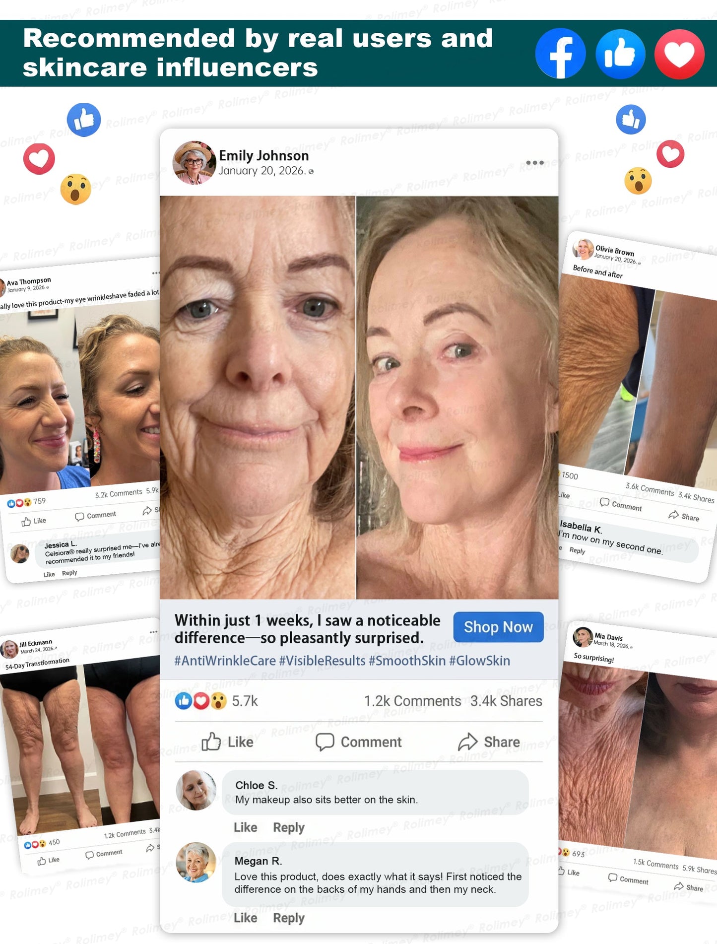 🌿👨‍⚕️CA HOT SALES ✨Rolimey® Botox & Stem Cell Wrinkle-Lift Tightening Cream