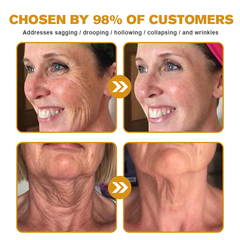 ✨🍀Made and shipped from Canada✅ Furzero™ Botox Bee Venom Wrinkle Removal Cream- LAST DAY 70% OFF