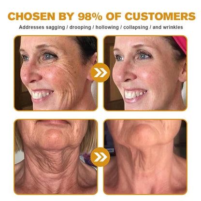✨🍀Made and shipped from Canada✅ Furzero™ Botox Bee Venom Wrinkle Removal Cream- LAST DAY 70% OFF
