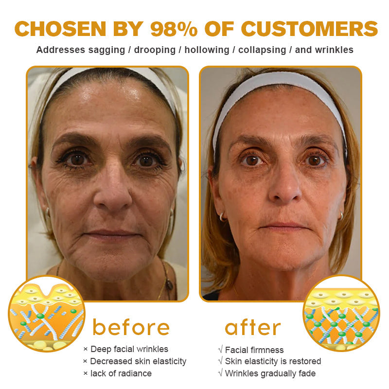 ✨🍀Made and shipped from Canada✅ Furzero™ Botox Bee Venom Wrinkle Removal Cream- LAST DAY 70% OFF