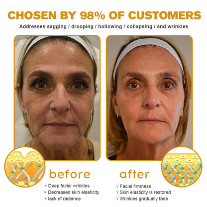 ✨🍀Made and shipped from Canada✅ Furzero™ Botox Bee Venom Wrinkle Removal Cream- LAST DAY 70% OFF